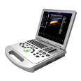 Color Doppler Ultrasound Machine Portable Color Doppler Ultrasound Laptop Color Doppler Ultrasound Diagnosis Instrument