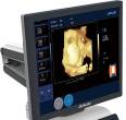 Color Doppler Ultrasound Diagnosis Instrument Medical Cart Color Doppler Ultrasound Machine DW-T6 with Stable Performance