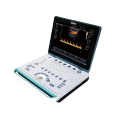 Kyle Laptop Color Ultrasound Manufacturer KR-E80 Color Ultrasound Obstetrics and Gynecology Color Doppler Ultrasound Diagnosis Instrument