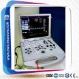 color doppler ultrasound scanner PW and 3D function