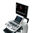 Full Digital Color Doppler Ultrasonic Diagnostic System Trolley Ultrasound scanner Machine