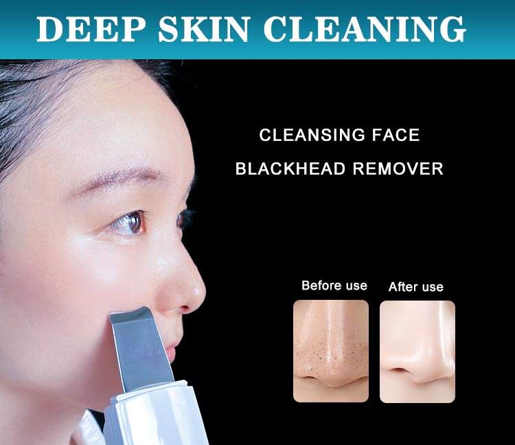 portable wholesale price stimulates ultrasonic face pore cleaner skin scrubber blackhead remover acne cosmetic instrument