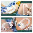 transparent wound catheter 5x6mm cannula ported iv dressing  with intravenous