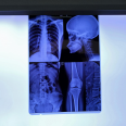 Inkjet digital x ray film soft ware dicom print Meidcal Blue positive PET Film For CT CR DR MRI