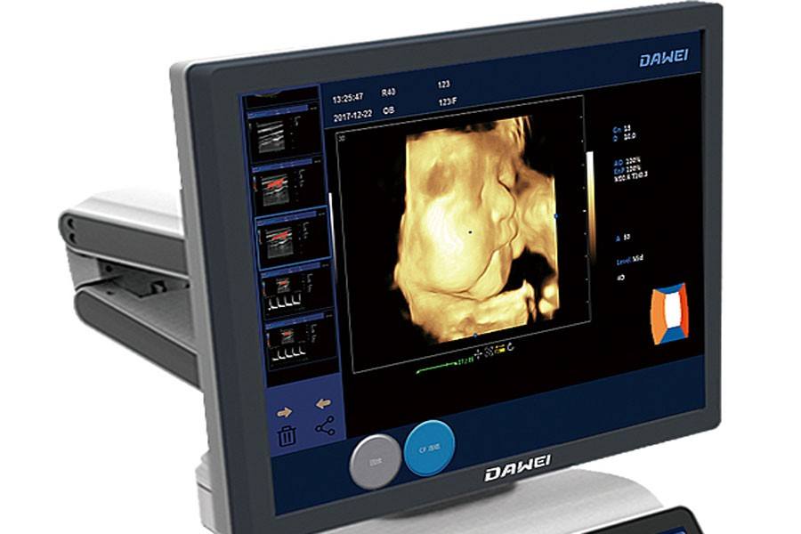 dual screen ultrasound machine &trolley color doppler ultrasound machine &real time 4D ultrasound DW-T6