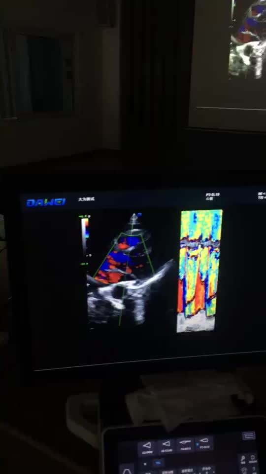 Echocardiograhy ultrasound machine & cardiac ultrasound DW-T70