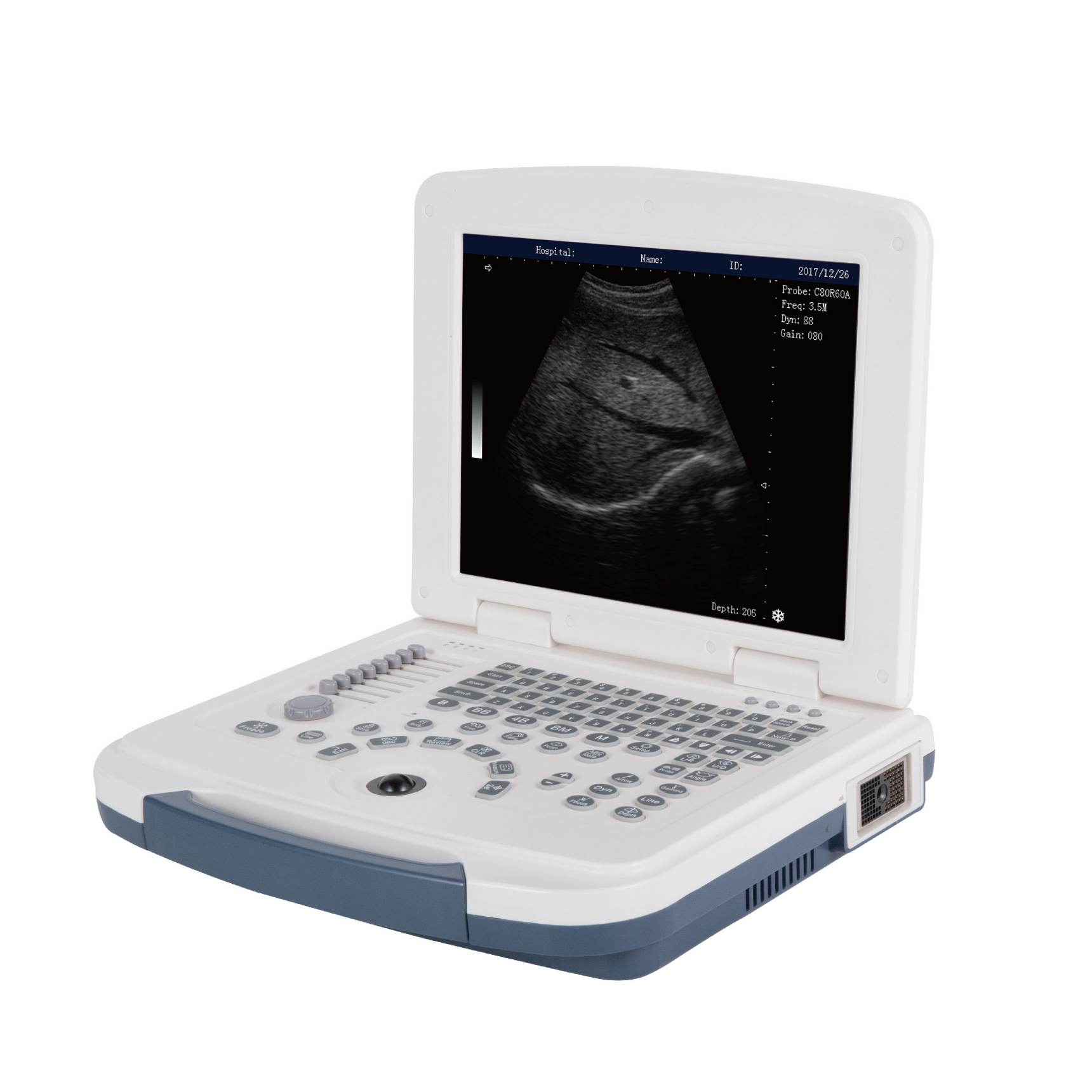 hot sells B/W ultrasonic diagnostic devices laptop ultrasound scan machine price