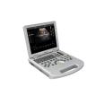 laptop portable color doppler ultrasound machine DW-L5