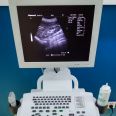 good quality trolley Ultrasound Diagnosis B Scanner ultrasound machine with trans vaginal probe