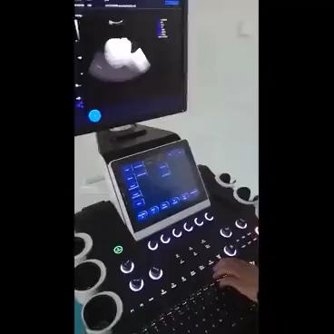 Dw-F5 Trolley ultrasonic system Economical Type 4D Color Doppler Ultrasound Scanner Baby Scan Imaging