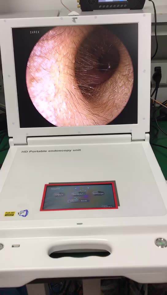 Integrated Portable Endoscopy HD Camera System Unit Ent Multi Function Portable Full HD Camera and 4 IN ONE Endoscope System