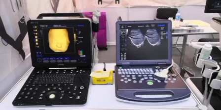 vet portable ultrasound machine medical handheld veterinary ultrasound scanner