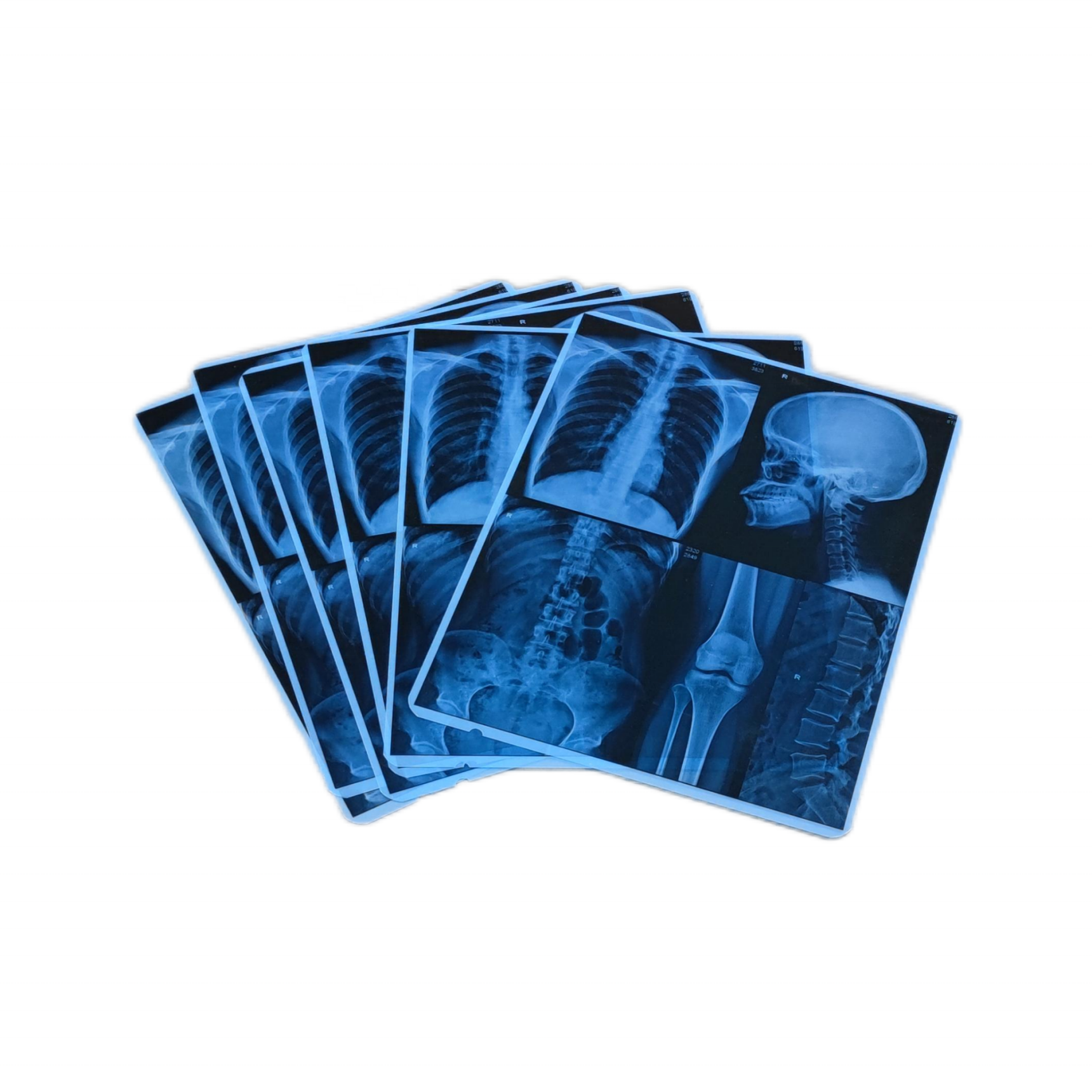 Blue based inkjet film for the medical image output