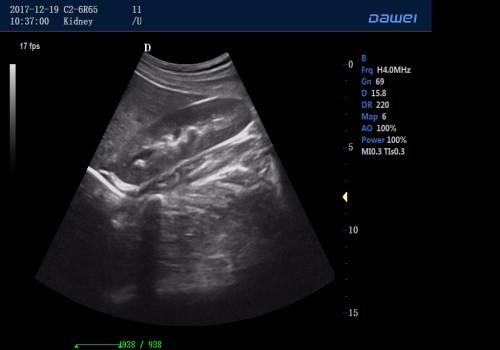 4D doppler ultrasound and high end color ultrasound scanner with CW function for cardiology
