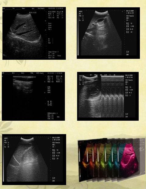 DW-370 trolley  ultrasound scanner & ultrasound sonography