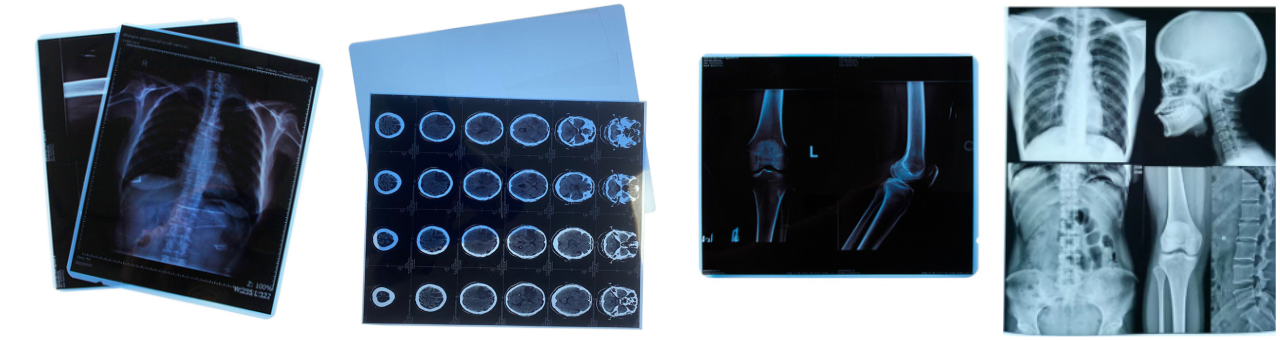 Blue based inkjet film for the medical image output