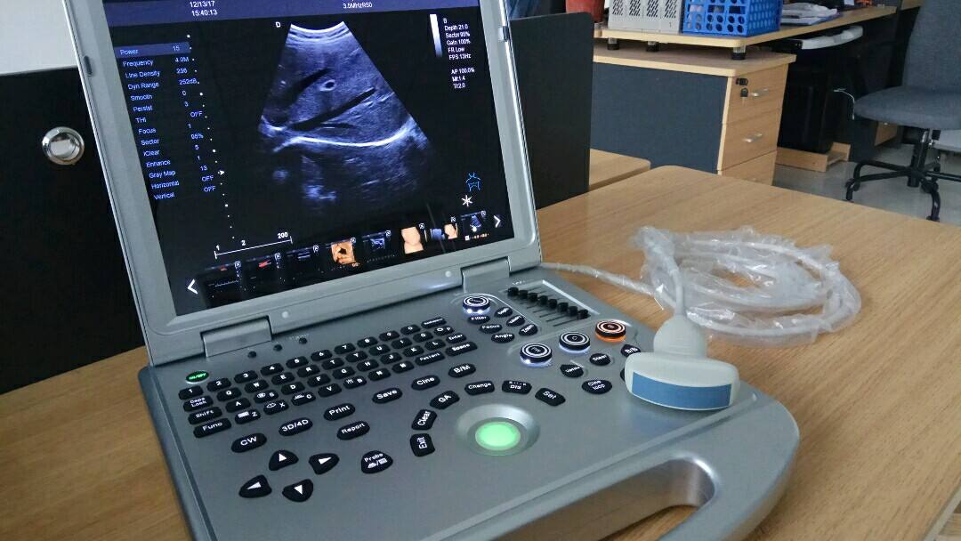 laptop portable color doppler ultrasound machine DW-L5