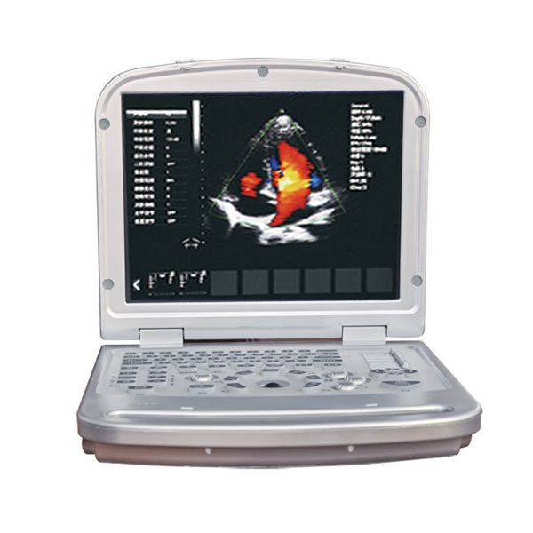 Hospital Used 3D Laptop Color Doppler Ultrasound Machine