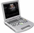 color doppler ultrasound scanner PW and 3D function