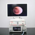 endoscope  system laparoscopic