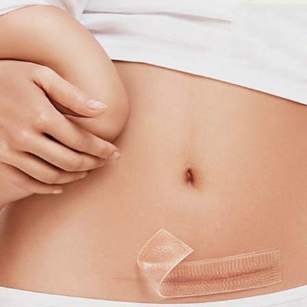 China 100% Effective C-section Silicone Gel Scar Removal Patch
