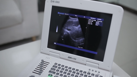 low cost DW500 ultrasonography portable black white ultrasound scanner machine price for sale