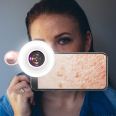 Mini Detector Fill Light 15x Macro Phone Camera Lens For Skin Pore Hair